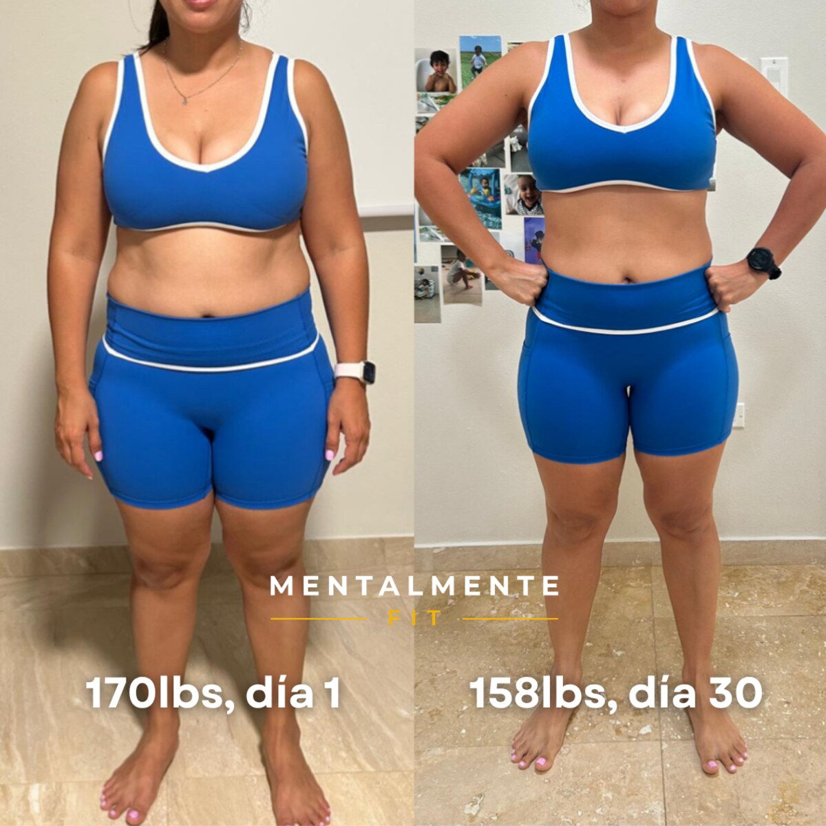 Transformación de Jenitza, vista frontal